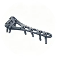 Locking Plate