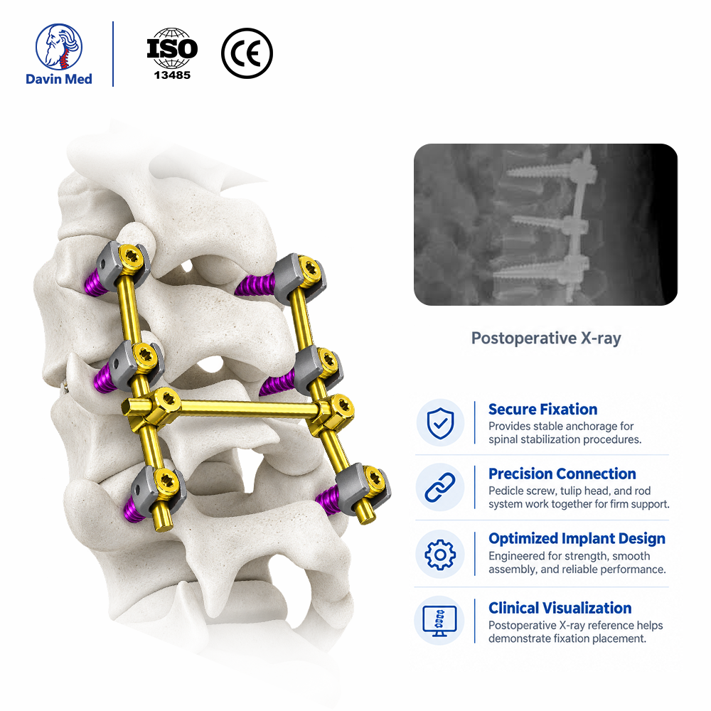 5.5-Polyaxial-Short-Tail-Pedicle-Screw1