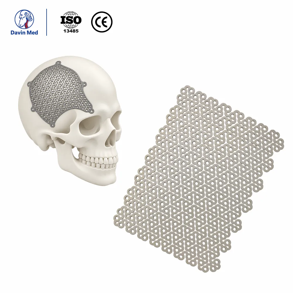 Davin-med-Cranial-Titanium-Mesh5