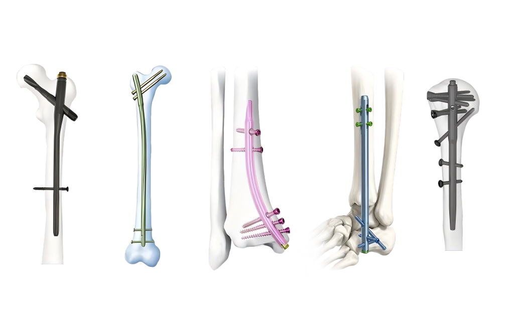 Intramedullary-Nail-System-banner1