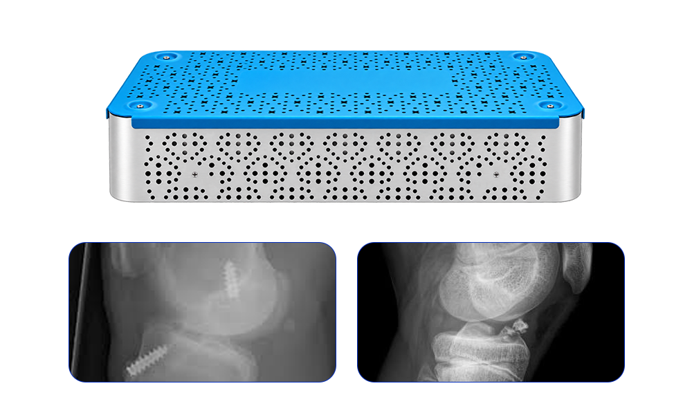 ACL Instrument Set product details and instrument configuration