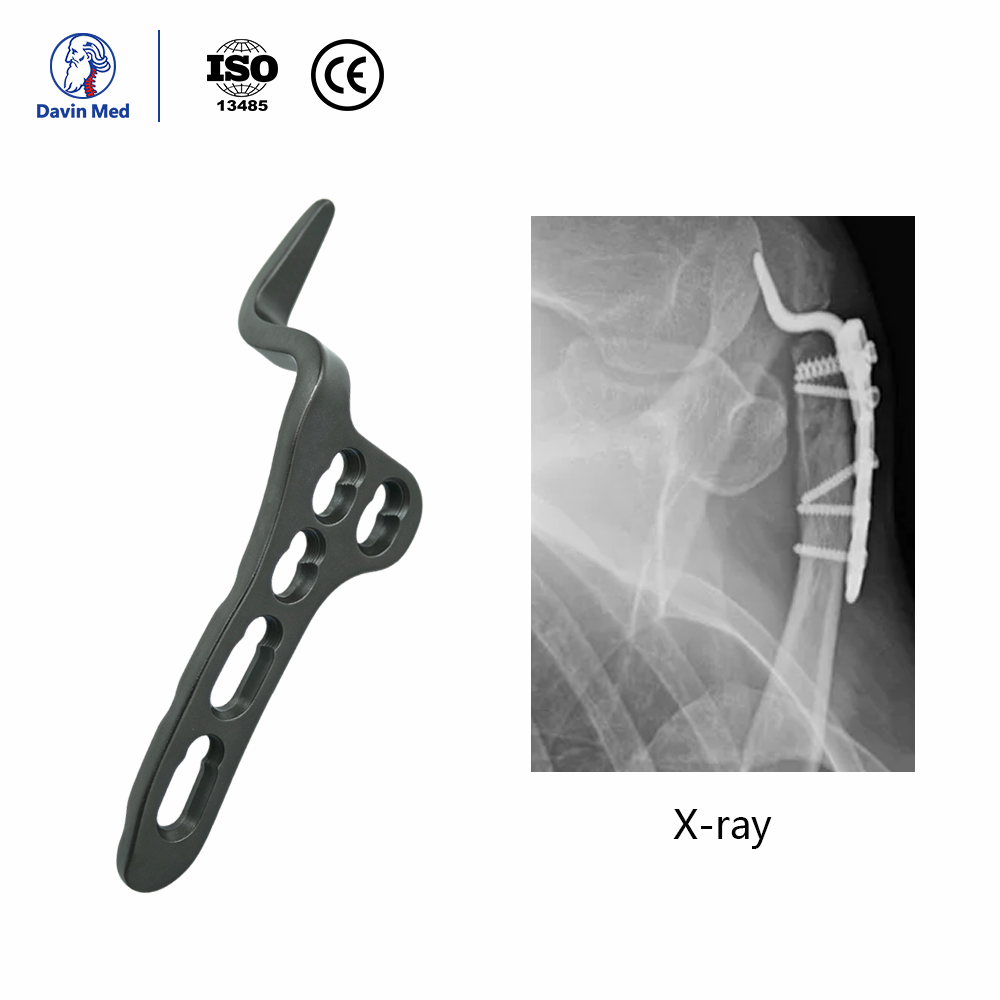 Davin-med-Clavicle-hook-locking-plate-Ⅱ4