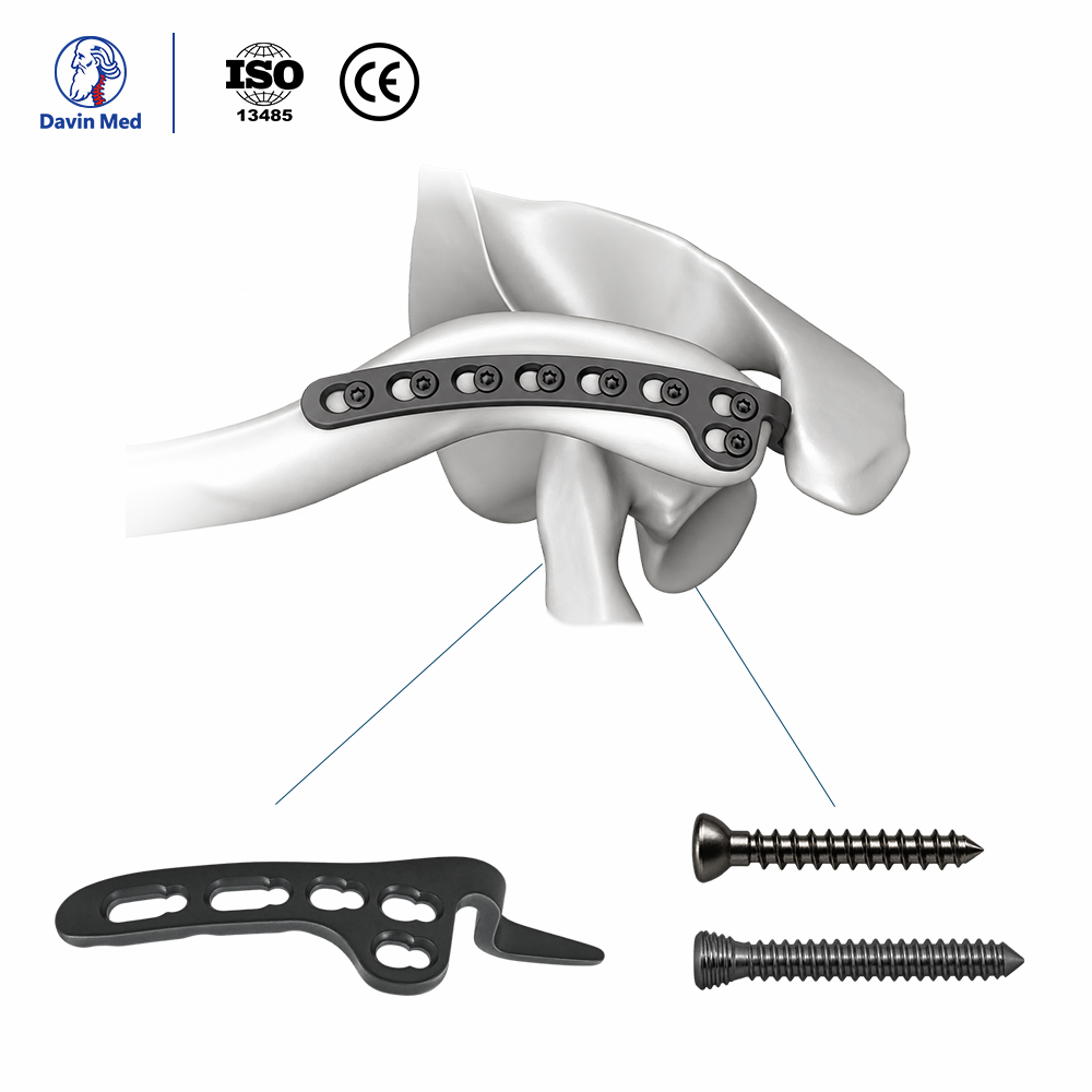 Davin-med-Clavicle-hook-locking-plate-Ⅱ5